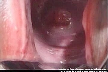 Stretching Out Gaping Fur Pie Meat With A Speculum